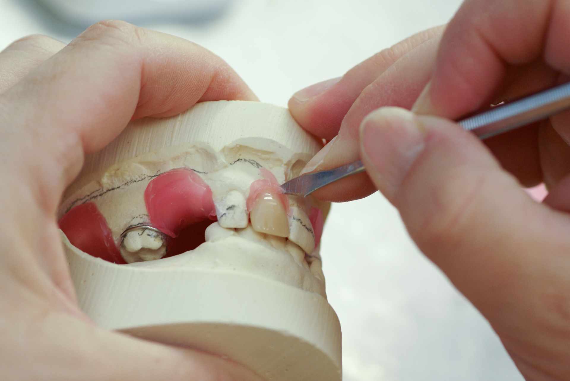 Making dentures, false teeth
