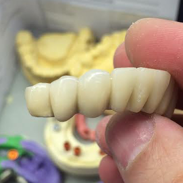 porcelain repairs at brighton dental lab